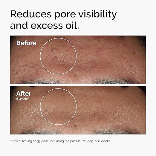 Niacinamide  Serum